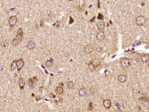 Paraformaldehyde-fixed, paraffin embedded rat brain; Antigen retrieval by boiling in sodium citrate buffer (pH6) for 15min; Block endogenous peroxidase by 3% hydrogen peroxide for 30 minutes; Blocking buffer (normal goat serum) at 37°C for 20min; Antibody incubation with _x000D_ Pyk2 (Tyr402) Polyclonal Antibody (bs-3400R) at 1:400 overnight at 4°C, followed by a conjugated secondary and DAB staining.