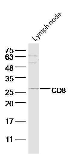 Mouse lymph node lysate probed with CD8a Polyclonal Antibody (bs-10699R) at 1:300 overnight in 4˚C. Followed by conjugation to the secondary antibody (bs-0295G-HRP) at 1:5000 90min in 37˚C. Mouse lymph node lysate probed with CD8a Polyclonal Antibody (bs-10699R) at 1:300 overnight in 4˚C. Followed by conjugation to the secondary antibody (bs-0295G-HRP) at 1:5000 90min in 37˚C.