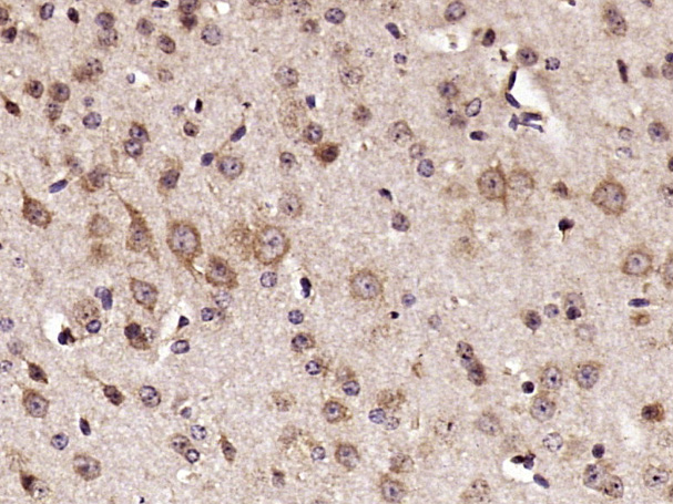 Paraformaldehyde-fixed, paraffin embedded mouse brain; Antigen retrieval by boiling in sodium citrate buffer (pH6) for 15min; Block endogenous peroxidase by 3% hydrogen peroxide for 30 minutes; Blocking buffer (normal goat serum) at 37°C for 20min; Antibody incubation with RPS6 Polyclonal Antibody (bs-3565R) at 1:400 overnight at 4°C, followed by a conjugated secondary and DAB staining.