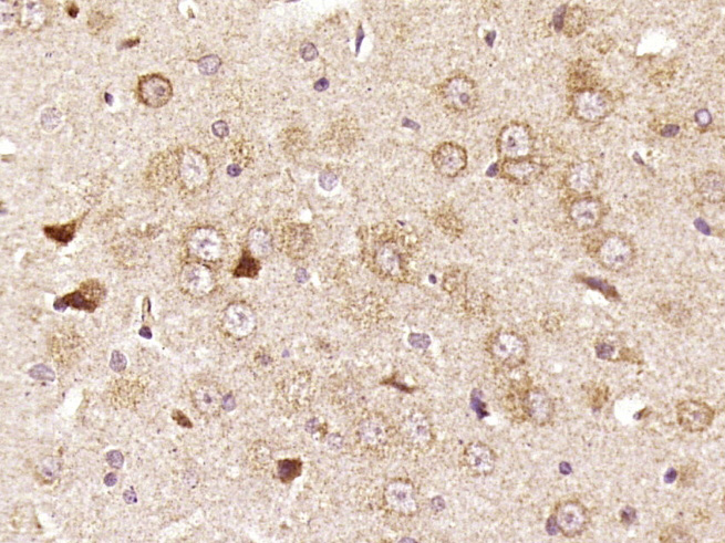 Paraformaldehyde-fixed, paraffin embedded rat brain; Antigen retrieval by boiling in sodium citrate buffer (pH6) for 15min; Block endogenous peroxidase by 3% hydrogen peroxide for 30 minutes; Blocking buffer (normal goat serum) at 37°C for 20min; Antibody incubation with RPS6 Polyclonal Antibody (bs-3565R) at 1:400 overnight at 4°C, followed by a conjugated secondary and DAB staining.