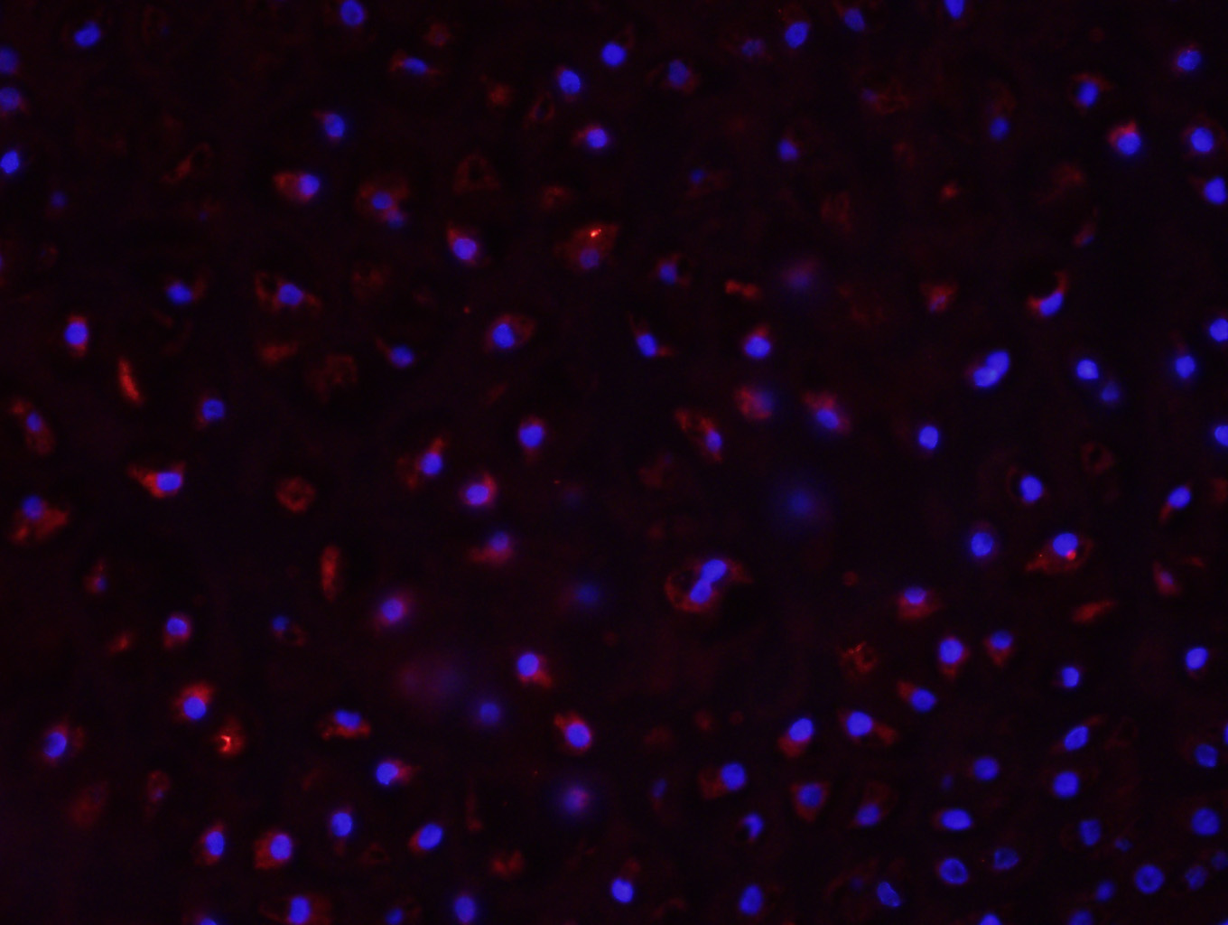 Paraformaldehyde-fixed, paraffin embedded Rat thyroid gland; Antigen retrieval by boiling in sodium citrate buffer (pH6.0) for 15min; Block endogenous peroxidase by 3% hydrogen peroxide for 20 minutes; Blocking buffer (normal goat serum) at 37°C for 30min; Antibody incubation with CYP11B1 Polyclonal Antibody, Unconjugated (bs-3898R) at 1:400 overnight at 4°C, followed by a conjugated secondary antibody (bs-0295G-cy3) for 90 minutes, and DAPI for nuclei staining. Paraformaldehyde-fixed, paraffin embedded Rat thyroid gland; Antigen retrieval by boiling in sodium citrate buffer (pH6.0) for 15min; Block endogenous peroxidase by 3% hydrogen peroxide for 20 minutes; Blocking buffer (normal goat serum) at 37°C for 30min; Antibody incubation with CYP11B1 Polyclonal Antibody, Unconjugated (bs-3898R) at 1:400 overnight at 4°C, followed by a conjugated secondary antibody (bs-0295G-cy3) for 90 minutes, and DAPI for nuclei staining.