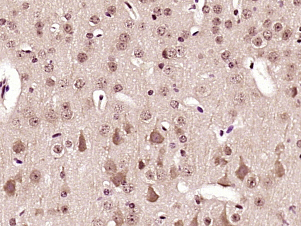 Paraformaldehyde-fixed, paraffin embedded mouse brain; Antigen retrieval by boiling in sodium citrate buffer (pH6) for 15min; Block endogenous peroxidase by 3% hydrogen peroxide for 30 minutes; Blocking buffer (normal goat serum) at 37°C for 20min; Antibody incubation with AMPK alpha-1/2 (Thr183/Thr172) Antibody (bs-4002R) at 1:400 overnight at 4°C, followed by a conjugated secondary and DAB staining.