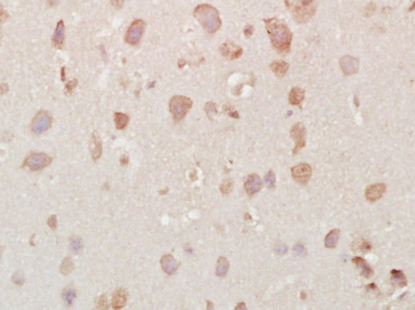 Paraformaldehyde-fixed, paraffin embedded mouse brain; Antigen retrieval by boiling in sodium citrate buffer (pH6) for 15min; Block endogenous peroxidase by 3% hydrogen peroxide for 30 minutes; Blocking buffer (normal goat serum) at 37°C for 20min; Antibody incubation with Vesicle docking protein p115 Antibody (bs-4258R) at 1:400 overnight at 4°C, followed by a conjugated secondary and DAB staining.