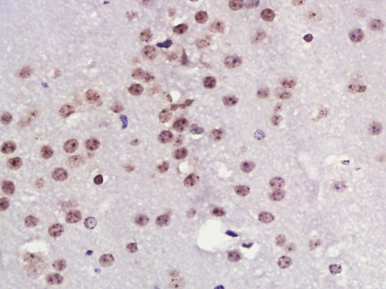 Paraformaldehyde-fixed, paraffin embedded mouse brain; Antigen retrieval by boiling in sodium citrate buffer (pH6) for 15min; Block endogenous peroxidase by 3% hydrogen peroxide for 30 minutes; Blocking buffer (normal goat serum) at 37°C for 20min; Antibody incubation with TPX2 Polyclonal Antibody (bs-4285R) at 1:400 overnight at 4°C, followed by a conjugated secondary and DAB staining.