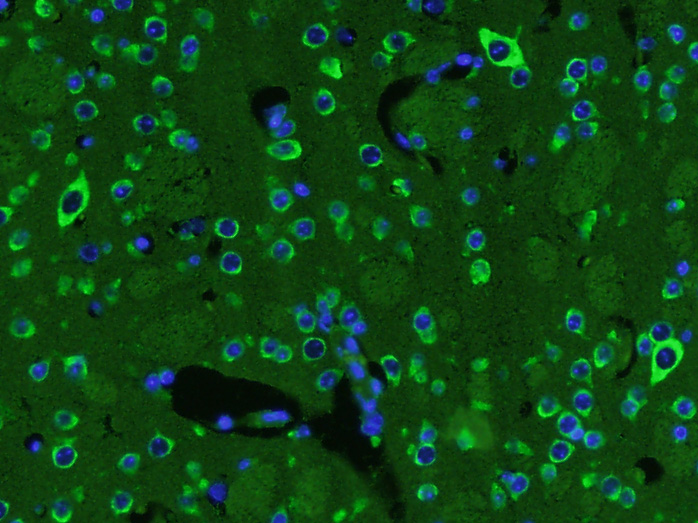 Paraformaldehyde-fixed, paraffin embedded mouse brain; Antigen retrieval by boiling in sodium citrate buffer (pH6) for 15min; Block endogenous peroxidase by 3% hydrogen peroxide for 30 minutes; Blocking buffer (normal goat serum) at 37°C for 20min; Antibody incubation with BDNF Polyclonal Antibody (bs-4989R) at 1:400 overnight at 4°C, followed by a conjugated secondary and DAB staining.