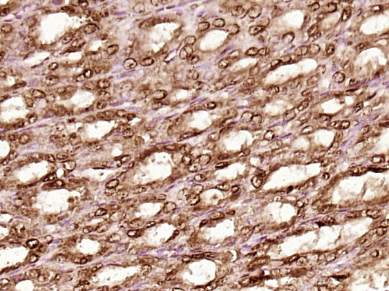 Paraformaldehyde-fixed, paraffin embedded rat stomach; Antigen retrieval by boiling in sodium citrate buffer (pH6) for 15min; Block endogenous peroxidase by 3% hydrogen peroxide for 30 minutes; Blocking buffer (normal goat serum) at 37°C for 20min; Antibody incubation with Hsc70 Polyclonal Antibody (bs-5117R) at 1:400 overnight at 4°C, followed by a conjugated secondary and DAB staining.