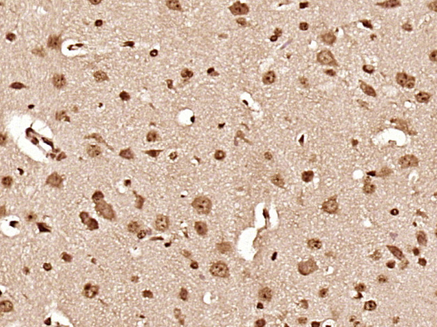 Paraformaldehyde-fixed, paraffin embedded mouse brain; Antigen retrieval by boiling in sodium citrate buffer (pH6) for 15min; Block endogenous peroxidase by 3% hydrogen peroxide for 30 minutes; Blocking buffer (normal goat serum) at 37°C for 20min; Antibody incubation with Hsc70 Polyclonal Antibody (bs-5117R) at 1:400 overnight at 4°C, followed by a conjugated secondary and DAB staining.