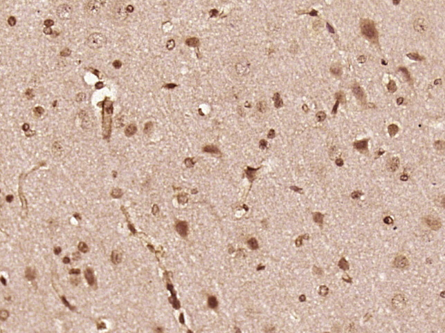 Paraformaldehyde-fixed, paraffin embedded rat brain; Antigen retrieval by boiling in sodium citrate buffer (pH6) for 15min; Block endogenous peroxidase by 3% hydrogen peroxide for 30 minutes; Blocking buffer (normal goat serum) at 37°C for 20min; Antibody incubation with FGFR1/FGFR2 (Tyr463/Tyr466) Antibody (bs-5326R) at 1:400 overnight at 4°C, followed by a conjugated secondary and DAB staining.
