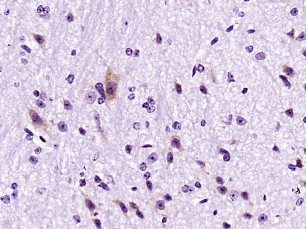 Paraformaldehyde-fixed, paraffin embedded rat brain; Antigen retrieval by boiling in sodium citrate buffer (pH6) for 15min; Block endogenous peroxidase by 3% hydrogen peroxide for 30 minutes; Blocking buffer (normal goat serum) at 37°C for 20min; Antibody incubation with FRS2(Tyr436) Polyclonal Antibody (bs-7902R) at 1:400 overnight at 4°C, followed by a conjugated secondary and DAB staining.