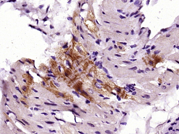 Paraformaldehyde-fixed, paraffin embedded rat heart; Antigen retrieval by boiling in sodium citrate buffer (pH6) for 15min; Block endogenous peroxidase by 3% hydrogen peroxide for 30 minutes; Blocking buffer (normal goat serum) at 37°C for 20min; Antibody incubation with FRS2(Tyr436) Polyclonal Antibody (bs-7902R) at 1:400 overnight at 4°C, followed by a conjugated secondary and DAB staining.