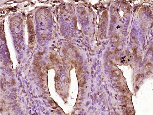 Paraformaldehyde-fixed, paraffin embedded mouse intestine tissue; Antigen retrieval by boiling in sodium citrate buffer (pH6.0) for 15min; Block endogenous peroxidase by 3% hydrogen peroxide for 20 minutes; Blocking buffer (normal goat serum) at 37°C for 30min; Antibody incubation with GIP Polyclonal Antibody, Unconjugated (bs-0098R) at 1:400 overnight at 4°C, followed by a conjugated secondary antibody and DAB staining.