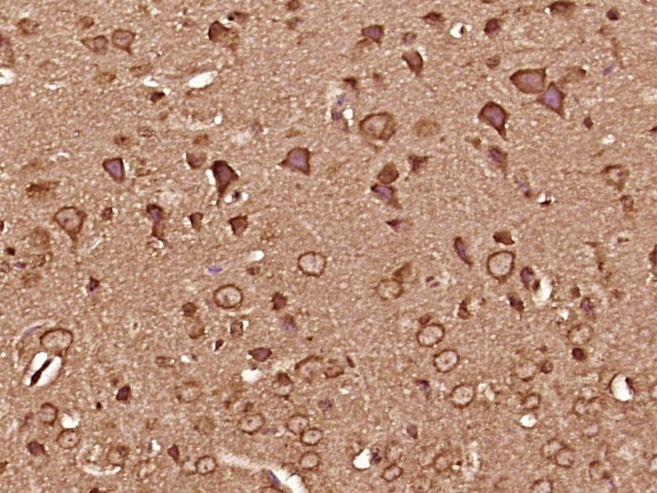 Paraformaldehyde-fixed, paraffin embedded mouse brain tissue; Antigen retrieval by boiling in sodium citrate buffer (pH6.0) for 15min; Block endogenous peroxidase by 3% hydrogen peroxide for 20 minutes; Blocking buffer (normal goat serum) at 37°C for 30min; Antibody incubation with CaMK2 Polyclonal Antibody, Unconjugated (bs-0541R) at 1:400 overnight at 4°C, followed by a conjugated secondary antibody and DAB staining.