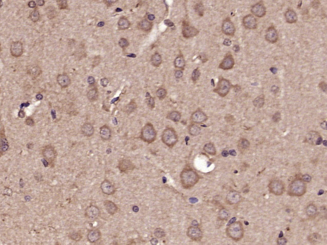 Paraformaldehyde-fixed, paraffin embedded rat brain tissue; Antigen retrieval by boiling in sodium citrate buffer (pH6.0) for 15min; Block endogenous peroxidase by 3% hydrogen peroxide for 20 minutes; Blocking buffer (normal goat serum) at 37°C for 30min; Antibody incubation with GluR1 (Ser863) Polyclonal Antibody, Unconjugated (bs-11632R) at 1:400 overnight at 4°C, followed by a conjugated secondary antibody and DAB staining.