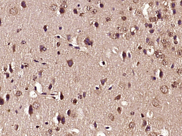 Paraformaldehyde-fixed, paraffin embedded mouse brain tissue; Antigen retrieval by boiling in sodium citrate buffer (pH6.0) for 15min; Block endogenous peroxidase by 3% hydrogen peroxide for 20 minutes; Blocking buffer (normal goat serum) at 37°C for 30min; Antibody incubation with GluR1 (Ser863) Polyclonal Antibody, Unconjugated (bs-11632R) at 1:400 overnight at 4°C, followed by a conjugated secondary antibody and DAB staining.