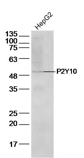 HepG2 Cell lysates probed with P2Y10 Polyclonal Antibody, unconjugated (bs-12070R) at 1:500 overnight at 4°C followed by a conjugated secondary antibody for 60 minutes at 37°C.