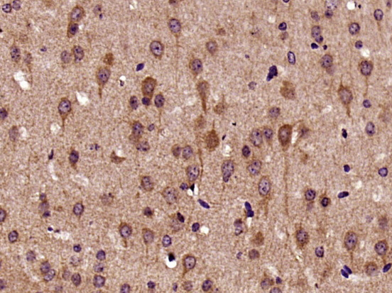 Paraformaldehyde-fixed, paraffin embedded mouse brain; Antigen retrieval by boiling in sodium citrate buffer (pH6) for 15min; Block endogenous peroxidase by 3% hydrogen peroxide for 30 minutes; Blocking buffer (normal goat serum) at 37°C for 20min; Antibody incubation with Biglycan Polyclonal Antibody (bs-7552R) at 1:400 overnight at 4°C, followed by a conjugated secondary and DAB staining.