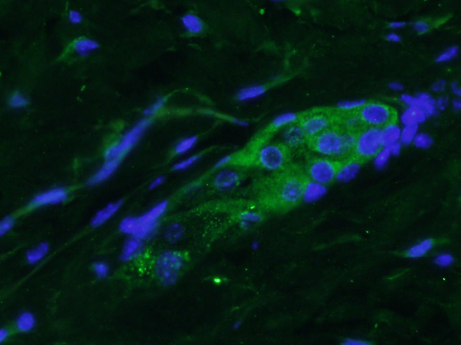 Paraformaldehyde-fixed, paraffin embedded mouse skin; Antigen retrieval by boiling in sodium citrate buffer (pH6) for 15min; Block endogenous peroxidase by 3% hydrogen peroxide for 30 minutes; Blocking buffer (normal goat serum) at 37°C for 20min; Antibody incubation with FGF18 Polyclonal Antibody (bs-9762R) at 1:400 overnight at 4°C, followed by conjugated Goat Anti-Rabbit IgG antibody (bs-0295G-FITC) for 90 minutes, and DAPI for nuclei staining.