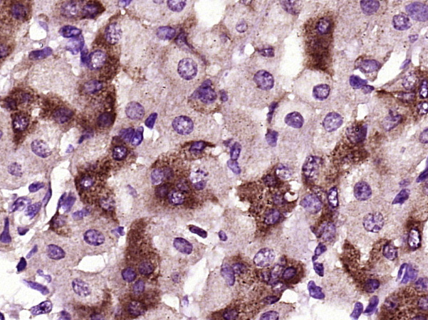 Paraformaldehyde-fixed, paraffin embedded mouse stomach; Antigen retrieval by boiling in sodium citrate buffer (pH6) for 15min; Block endogenous peroxidase by 3% hydrogen peroxide for 30 minutes; Blocking buffer (normal goat serum) at 37°C for 20min; Antibody incubation with RNF128 Polyclonal Antibody (bs-9251R) at 1:400 overnight at 4°C, followed by a conjugated secondary and DAB staining.