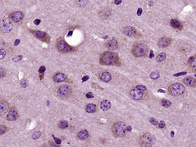 Paraformaldehyde-fixed, paraffin embedded mouse brain; Antigen retrieval by boiling in sodium citrate buffer (pH6) for 15min; Block endogenous peroxidase by 3% hydrogen peroxide for 30 minutes; Blocking buffer (normal goat serum) at 37°C for 20min; Antibody incubation with RNF128 Polyclonal Antibody (bs-9251R) at 1:400 overnight at 4°C, followed by a conjugated secondary and DAB staining. Paraformaldehyde-fixed, paraffin embedded mouse brain; Antigen retrieval by boiling in sodium citrate buffer (pH6) for 15min; Block endogenous peroxidase by 3% hydrogen peroxide for 30 minutes; Blocking buffer (normal goat serum) at 37°C for 20min; Antibody incubation with RNF128 Polyclonal Antibody (bs-9251R) at 1:400 overnight at 4°C, followed by a conjugated secondary and DAB staining.