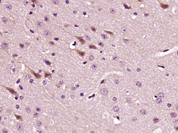 Paraformaldehyde-fixed, paraffin embedded mouse brain; Antigen retrieval by boiling in sodium citrate buffer (pH6) for 15min; Block endogenous peroxidase by 3% hydrogen peroxide for 30 minutes; Blocking buffer (normal goat serum) at 37°C for 20min; Antibody incubation with LPCAT2 Polyclonal Antibody (bs-10742R) at 1:400 overnight at 4°C, followed by a conjugated secondary and DAB staining.