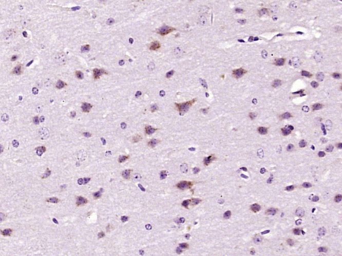 Paraformaldehyde-fixed, paraffin embedded mouse brain; Antigen retrieval by boiling in sodium citrate buffer (pH6) for 15min; Block endogenous peroxidase by 3% hydrogen peroxide for 30 minutes; Blocking buffer (normal goat serum) at 37°C for 20min; Antibody incubation with _x000D_ p90RSK (Ser380) Polyclonal Antibody (bs-3362R) at 1:400 overnight at 4°C, followed by a conjugated secondary and DAB staining.