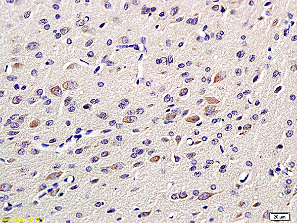 Formalin-fixed and paraffin embedded: rat brain tissue labeled with Anti-GAP-43 Polyclonal Antibody, Unconjugated (bs-0154R) at 1:200 followed by conjugation to the secondary antibody and DAB staining