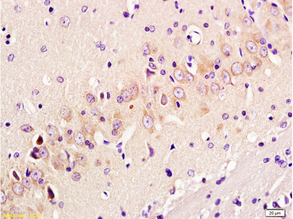 Formalin-fixed and paraffin embedded: rat brain tissue labeled with Anti-GAP-43 Polyclonal Antibody, Unconjugated (bs-0154R) at 1:300 followed by conjugation to the secondary antibody and DAB staining