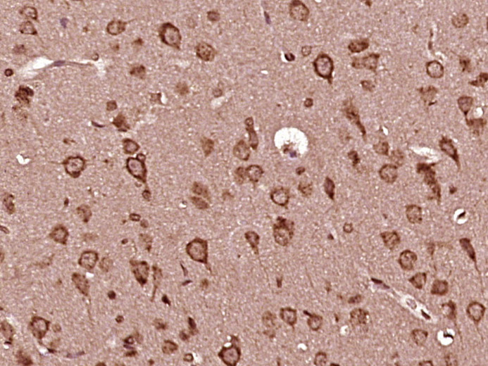 Paraformaldehyde-fixed, paraffin embedded rat brain tissue; Antigen retrieval by boiling in sodium citrate buffer (pH6.0) for 15min; Block endogenous peroxidase by 3% hydrogen peroxide for 20 minutes; Blocking buffer (normal goat serum) at 37°C for 30min; Antibody incubation with alpha MSH Polyclonal Antibody, Unconjugated (bs-1848R) at 1:400 overnight at 4°C, followed by a conjugated secondary antibody and DAB staining. Paraformaldehyde-fixed, paraffin embedded rat brain tissue; Antigen retrieval by boiling in sodium citrate buffer (pH6.0) for 15min; Block endogenous peroxidase by 3% hydrogen peroxide for 20 minutes; Blocking buffer (normal goat serum) at 37°C for 30min; Antibody incubation with alpha MSH Polyclonal Antibody, Unconjugated (bs-1848R) at 1:400 overnight at 4°C, followed by a conjugated secondary antibody and DAB staining.