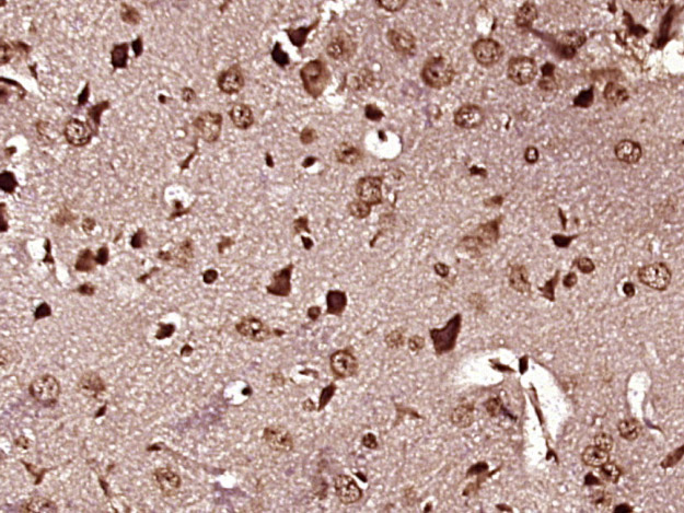 Paraformaldehyde-fixed, paraffin embedded mouse brain tissue; Antigen retrieval by boiling in sodium citrate buffer (pH6.0) for 15min; Block endogenous peroxidase by 3% hydrogen peroxide for 20 minutes; Blocking buffer (normal goat serum) at 37°C for 30min; Antibody incubation with alpha MSH Polyclonal Antibody, Unconjugated (bs-1848R) at 1:400 overnight at 4°C, followed by a conjugated secondary antibody and DAB staining.