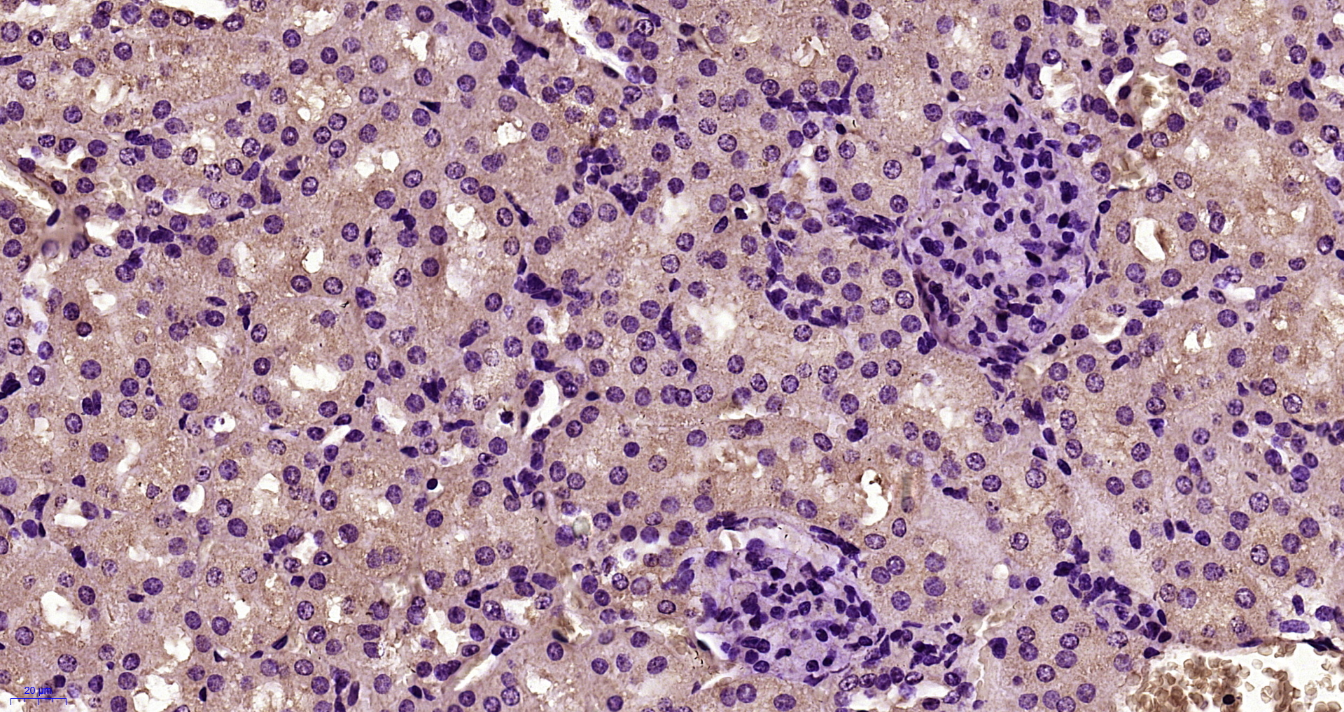 Paraformaldehyde-fixed, paraffin embedded Mouse kidney; Antigen retrieval by boiling in sodium citrate buffer (pH6.0) for 15min; Block endogenous peroxidase by 3% hydrogen peroxide for 20 minutes; Blocking buffer (normal goat serum) at 37°C for 30min; Antibody incubation with Desmoglein 2 Polyclonal Antibody, Unconjugated (bs-10152R) at 1:400 overnight at 4°C, followed by a conjugated secondary antibody and DAB staining.