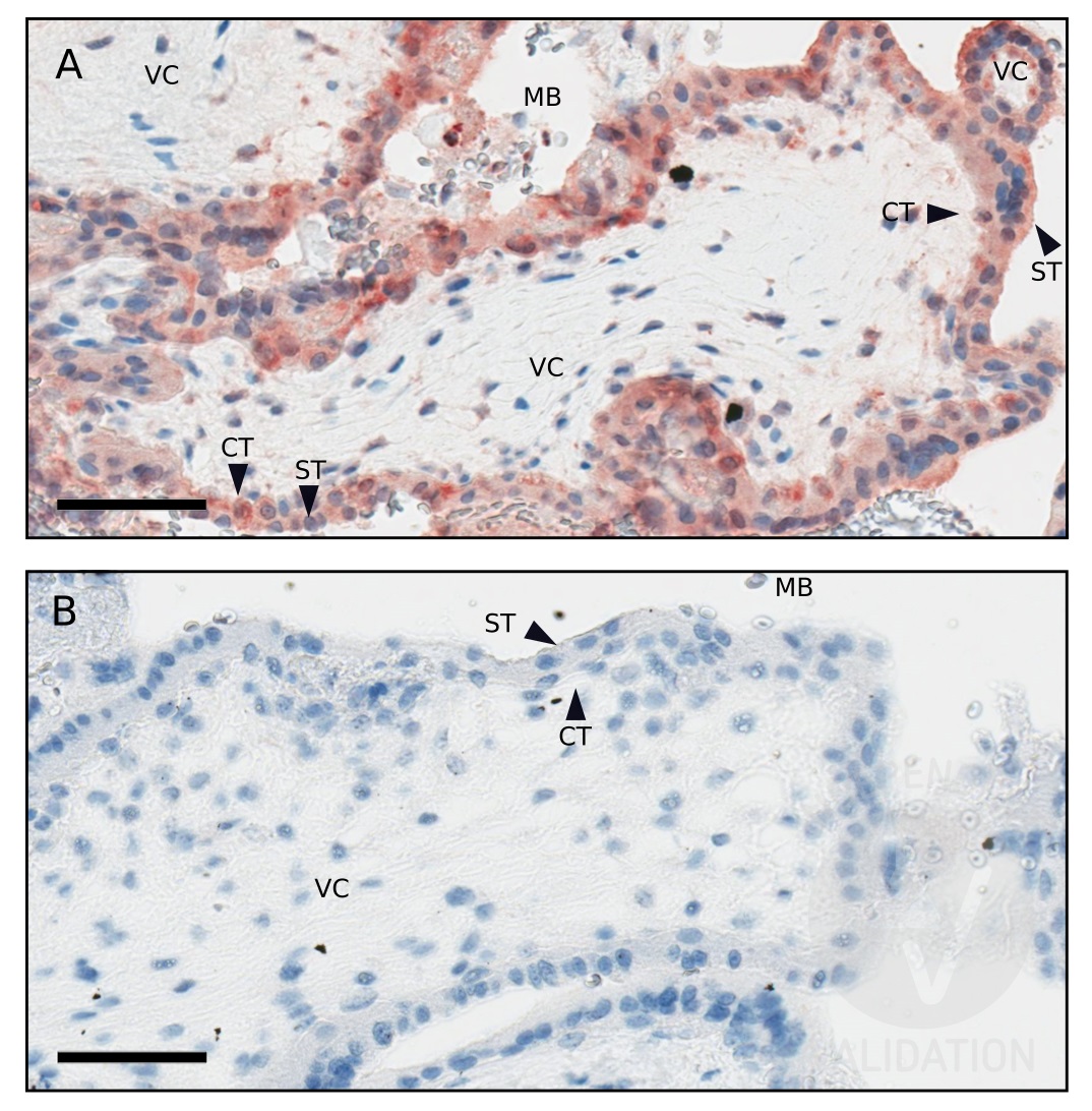 Staining of Placental villus from 7w gestation karyotype-normal pregnancy with bs-7351R. The Positive Control used is Placental villus from 7w gestation karyotype-normal pregnancy. The Negative Control used was KLH antibody. Images were taken at 400x magnification, bars represent 60\u00b5m. Figure legend: VC: villus core, CT: cytotrophoblast, ST: syncytiotrophoblast, MB: maternal blood space bathing placental villi. Image was kindly submitted by a researcher via the Antibodies Online Independent Validation Program.