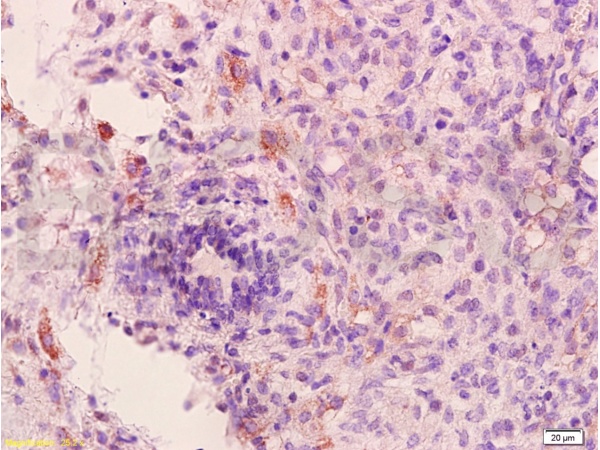 Formalin-fixed and paraffin embedded rat brain tissue labeled with Anti-VEGFR1/FLT1 Polyclonal Antibody, Unconjugated (bs-0170R) at 1:400 followed by conjugation to the secondary antibody and DAB staining