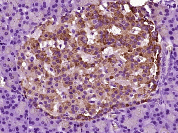 Paraformaldehyde-fixed, paraffin embedded rat pancreas tissue; Antigen retrieval by boiling in sodium citrate buffer (pH6.0) for 15min; Block endogenous peroxidase by 3% hydrogen peroxide for 20 minutes; Blocking buffer (normal goat serum) at 37°C for 30min; Antibody incubation with ASK1 (Ser967) Polyclonal Antibody, Unconjugated (bs-3029R) at 1:400 overnight at 4°C, followed by a conjugated secondary antibody and DAB staining.