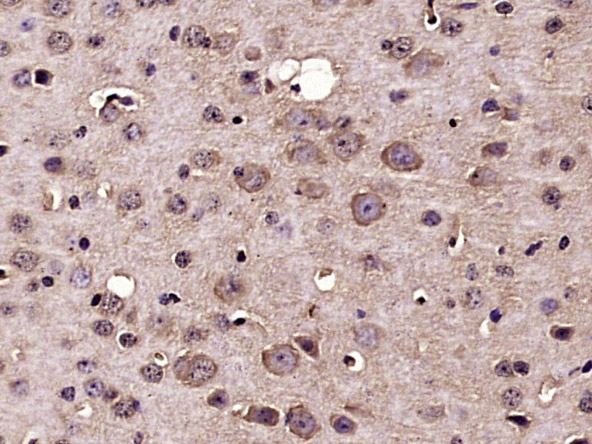 Paraformaldehyde-fixed, paraffin embedded mouse brain; Antigen retrieval by boiling in sodium citrate buffer (pH6) for 15min; Block endogenous peroxidase by 3% hydrogen peroxide for 30 minutes; Blocking buffer (normal goat serum) at 37°C for 20min; Antibody incubation with Nucleoporin p62 Polyclonal Antibody(bs-2935R) at 1:400 overnight at 4°C, followed by a conjugated secondary and DAB staining.