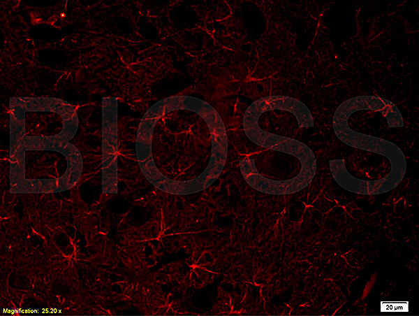 Formalin-fixed and paraffin embedded: human placenta tissue labeled with Anti-GFAP Polyclonal Antibody, Unconjugated (bs-0199R) at 1:800, followed by conjugation to the secondary antibody Goat Anti-Rabbit IgG, Cy3 conjugated (bs-0295G-Cy3) used at 1:200 dilution for 40 minutes at 37°C