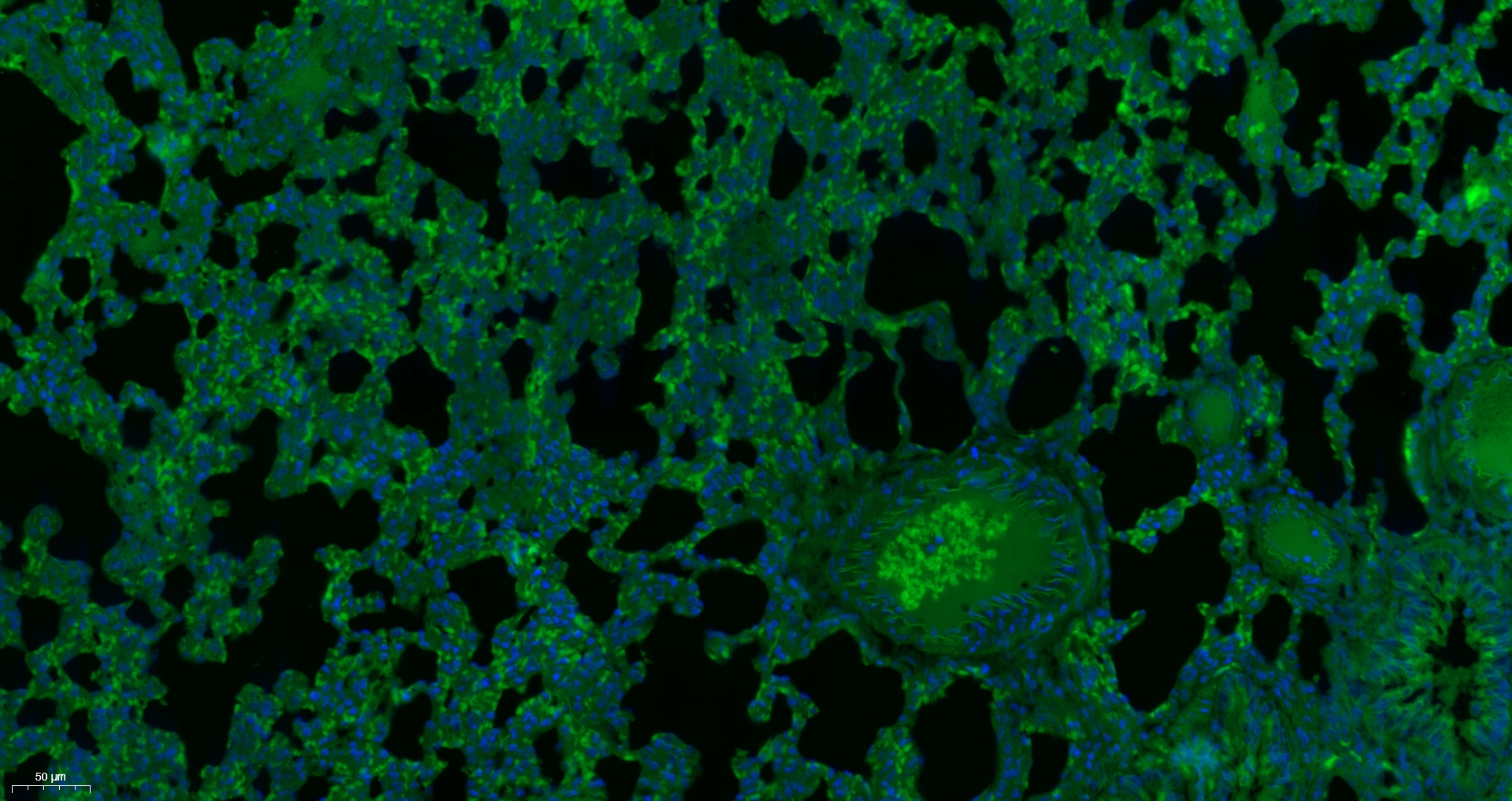 Paraformaldehyde-fixed, paraffin embedded rat lung; Antigen retrieval by boiling in sodium citrate buffer (pH6) for 15min; Block endogenous peroxidase by 3% hydrogen peroxide for 30 minutes; Blocking buffer (normal goat serum) at 37°C for 20min; Antibody incubation with Alpha Glucosidase Polyclonal Antibody (bs-13254R) at 1:200 overnight at 4°C, followed by a conjugated secondary.