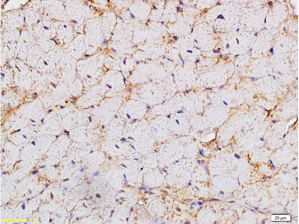 Formalin-fixed and paraffin embedded rat heart labeled with Anti-HCN4 Polyclonal Antibody, Unconjugated (bs-1691R) at 1:200 followed by conjugation to the secondary antibody and DAB staining.