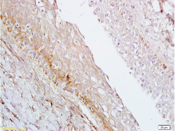 Formalin-fixed and paraffin embedded rat ovary tissue labeled with Anti-AGPAT4 Polyclonal Antibody, Unconjugated (bs-5033R) at 1:200 followed by conjugation to the secondary antibody, (SP-0023), and DAB staining