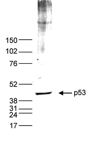 Nuclear extracts of HeLa cells (40 μg) were analysed by Western blot using p53 Polyclonal Antibody (bs-53127R) diluted 1:2,000 in TBS-Tween containing 5% skimmed milk. Followed by secondary antibody incubation.