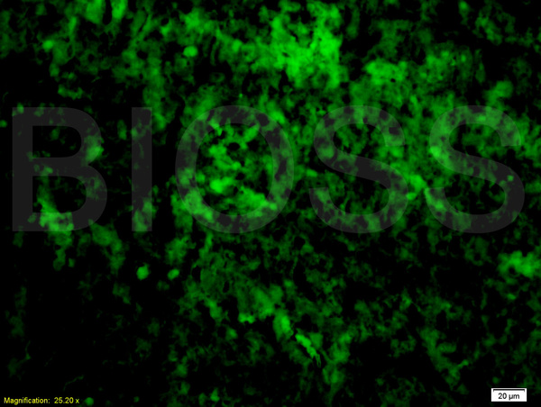 Formalin-fixed and paraffin embedded mouse lymphoma tissue labeled with Anti-TNF-alpha Polyclonal Antibody, FITC conjugated (bsm-0387M-FITC) at 1:200 followed by conjugation to the secondary antibody