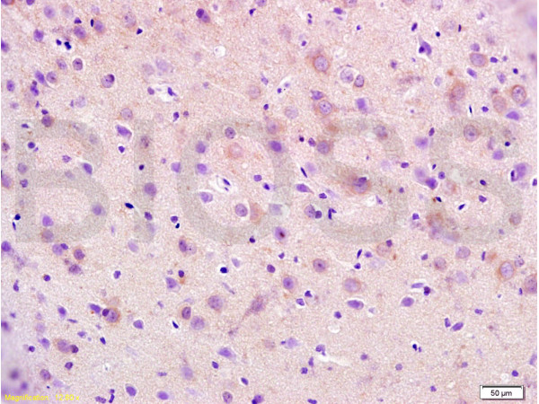 Formalin-fixed and paraffin embedded mouse brain tissue labeled with Anti-RAP1A Polyclonal Antibody, Unconjugated (bs-1504R) at 1:200 followed by conjugation to the secondary antibody, (SP-0023), and DAB staining