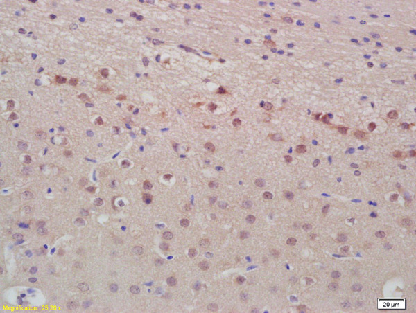 Formalin-fixed and paraffin embedded rat brain labeled with Anti-ANP Polyclonal Antibody, Unconjugated (bs-2040R) at 1:200, followed by conjugation to the secondary antibody and DAB staining