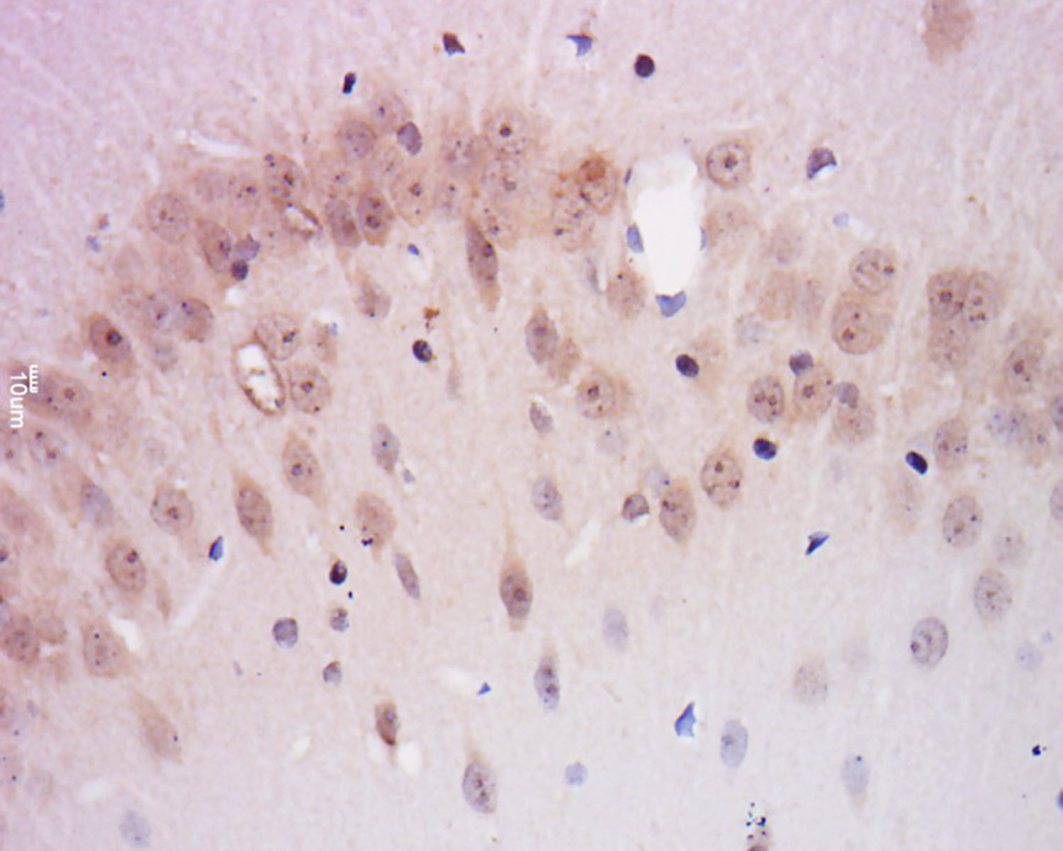 Paraformaldehyde-fixed, paraffin embedded Rat brain tissue; Antigen retrieval by boiling in sodium citrate buffer(pH6) for 15 minutes; Block endogenous peroxidase by 3% hydrogen peroxide for 30 minutes; Blocking buffer (normal goat serum) at 37°C for 20 minutes; Antibody incubation with CEB1 Polyclonal Antibody, Unconjugated (bs-15445R) at 1:200 overnight at 4°C, followed by a conjugated secondary antibody and DAB staining.