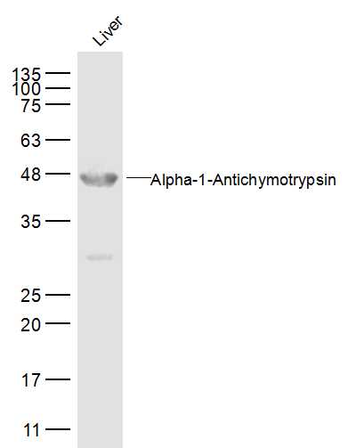 Liver lysates probed withAACT Alpha1 Polyclonal Antibody, Unconjugated (bs-0094R) at 1:500 dilution and 4˚C overnight incubation. Followed by conjugated secondary antibody incubation at 1:10000 for 60 min at 37˚C.
