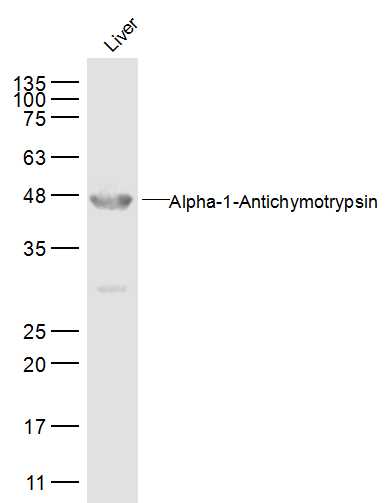 Liver lysates probed withAACT Alpha1 Polyclonal Antibody, Unconjugated (bs-0094R) at 1:500 dilution and 4˚C overnight incubation. Followed by conjugated secondary antibody incubation at 1:10000 for 60 min at 37˚C. Liver lysates probed withAACT Alpha1 Polyclonal Antibody, Unconjugated (bs-0094R) at 1:500 dilution and 4˚C overnight incubation. Followed by conjugated secondary antibody incubation at 1:10000 for 60 min at 37˚C.
