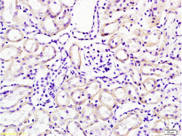 Formalin-fixed and paraffin embedded mouse kidney tissue labeled with Anti-Cathepsin H Polyclonal Antibody, Unconjugated (bs-1670R) at 1:200 followed by conjugation to the secondary antibody, (SP-0023), and DAB staining