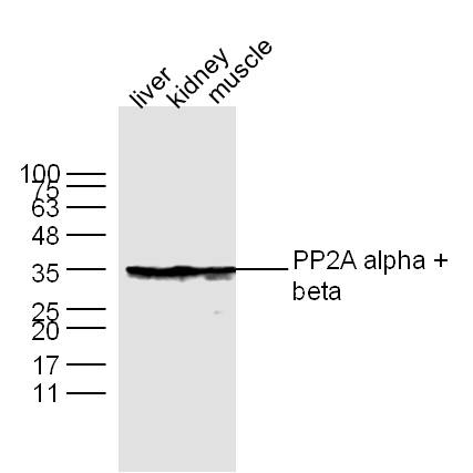 Lane 1: Liver lysates; Lane 2: Kidney lysates; Lane 3: Muscle lysates probed with PP2A alpha + beta Polyclonal Antibody, Unconjugated (bs-0029R) at 1:300 dilution and 4°C overnight incubation. Followed by conjugated secondary antibody incubation at 1:10000 for 60 min at 37°C.