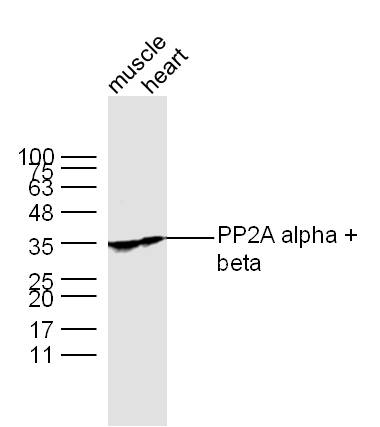 Lane 1: Muscle lysates; Lane 2: Heart lysates probed with PP2A alpha + beta Polyclonal Antibody, Unconjugated (bs-0029R) at 1:300 dilution and 4°C overnight incubation. Followed by conjugated secondary antibody incubation at 1:10000 for 60 min at 37°C.