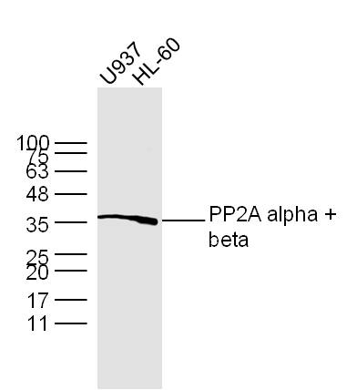 Lane 1: U937 lysates; Lane 2: HL-60 lysates probed with PP2A alpha + beta Polyclonal Antibody, Unconjugated (bs-0029R) at 1:300 dilution and 4˚C overnight incubation. Followed by conjugated secondary antibody incubation at 1:10000 for 60 min at 37˚C.