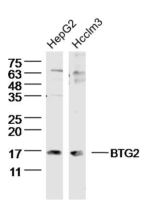 Lane 1: HepG2 lysates; Lane 2: Hcclm3 lysates probed with BTG2 Polyclonal Antibody, Unconjugated (bs-0031R) at 1:300 dilution and 4°C overnight incubation. Followed by conjugated secondary antibody incubation at 1:10000 for 60 min at 37°C.